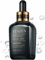 Никотинамидная сыворотка сужающая поры Venzen
