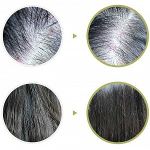 Lador Маска - пилинг для волос с чайным деревом Tea Tree Scalp Clinic Hair Pack, 200 мл