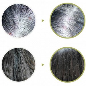 Lador Маска-пилинг для кожи головы с чайным деревом Tea Tree Scalp Hair Pack