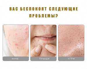 Профессиональный набор инструментов для удаления акне и чёрных точек Lanbena, Rose Gold