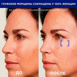 LOreal Ревиталифт Ночная сыворотка 0,2% чистый ретинол от всех видов морщин даже глубоких