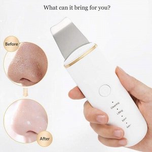 Ультразвуковой прибор Face Skin Cleaning Scrubber