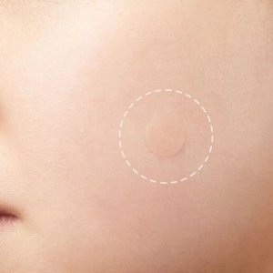 Elizavecca Witch Piggy Hell Pore Blemish Spot Patch Точечные патчи против акне