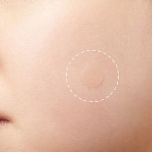 Elizavecca Witch Piggy Hell Pore Blemish Spot Patch Точечные патчи против акне