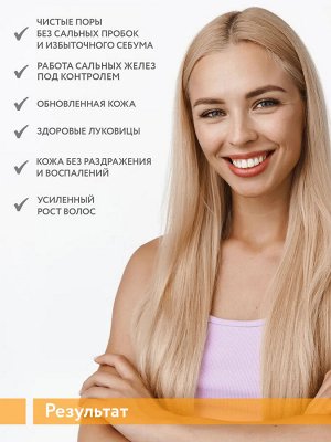 ARAVIA Professional Гель-эксфолиант мультикислотный для глубокого очищения кожи головы Scalp AHA-Peel. Аравия