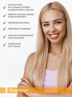 ARAVIA Professional Гель-эксфолиант мультикислотный для глубокого очищения кожи головы Scalp AHA-Peel