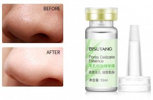 Набор сывороток для очищения от черных точек и сужения пор Bisutang Suction Blackhead Remover, 2 шт. * 10 мл.