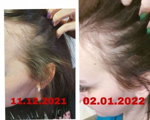 Сыворотка-спрей для роста волос FlaxHair