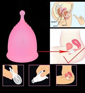 Менструальная чашка с круглой головкой iCare, розовая