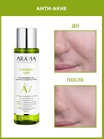 &quot;ARAVIA Laboratories&quot; Успокаивающий тоник для жирной и проблемной кожи Anti-Acne Tonic, 250 мл