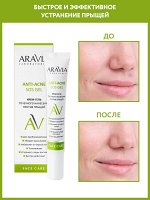 Крем-гель точечного нанесения против прыщей Anti-acne SOS Gel, 20 мл