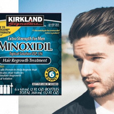 Minoxidil. Лечение залысин и выпадения волос! Рост бороды