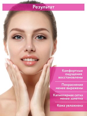 ARAVIA Professional Корректирующая маска для чувствительной кожи с куперозом Couperose Active Mask