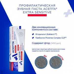 Асепта паста зубная профилактическая экстра сенситив туба 75МЛ