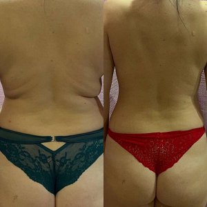 FlaxTap Горячее обертывание FlaxBody