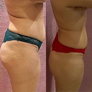 FlaxTap Горячее обертывание FlaxBody