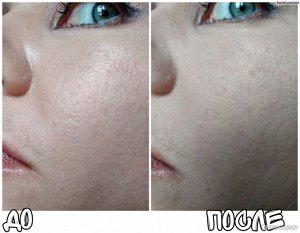 Матирующий абсорбирующий многоразовый роллер из вулканического камня против жирного блеска на лице