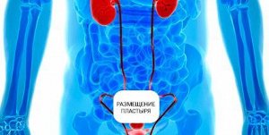Hemani Пластырь от простатита &quot;Prostatic Navel Plasters&quot;