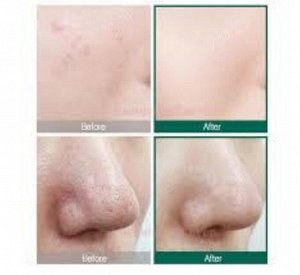 Some By Mi Крем для проблемной кожи лица восстанавливающий Aha-Bha-Pha 30 Days Miracle Cream, 60 гр