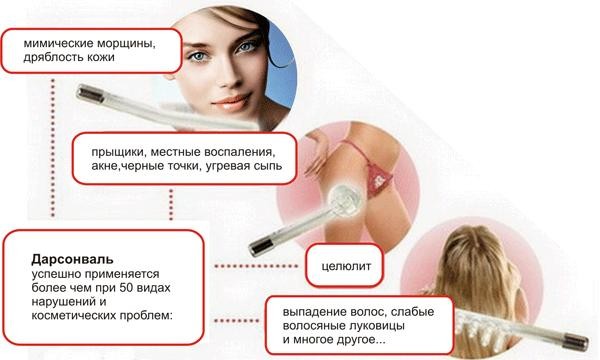 Дарсонваль до после лицо
