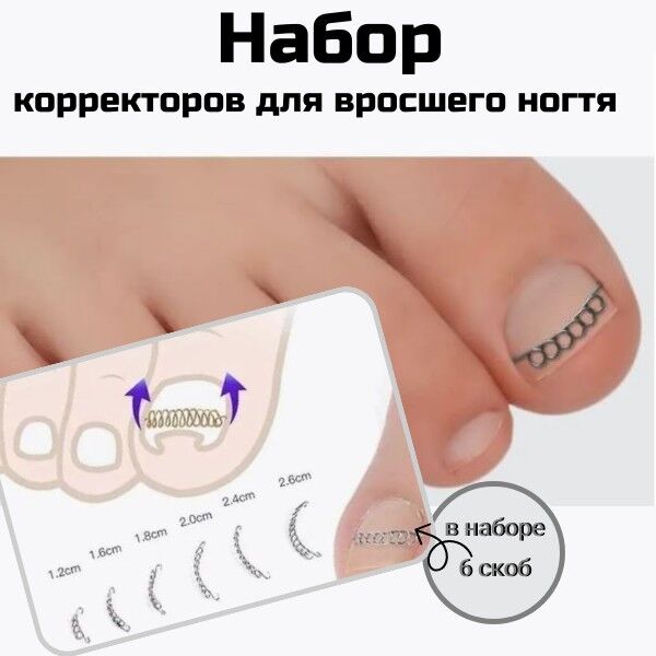 Набор корректоров от вросшего ногтя | Пластыри, корректоры. Инструменты ...